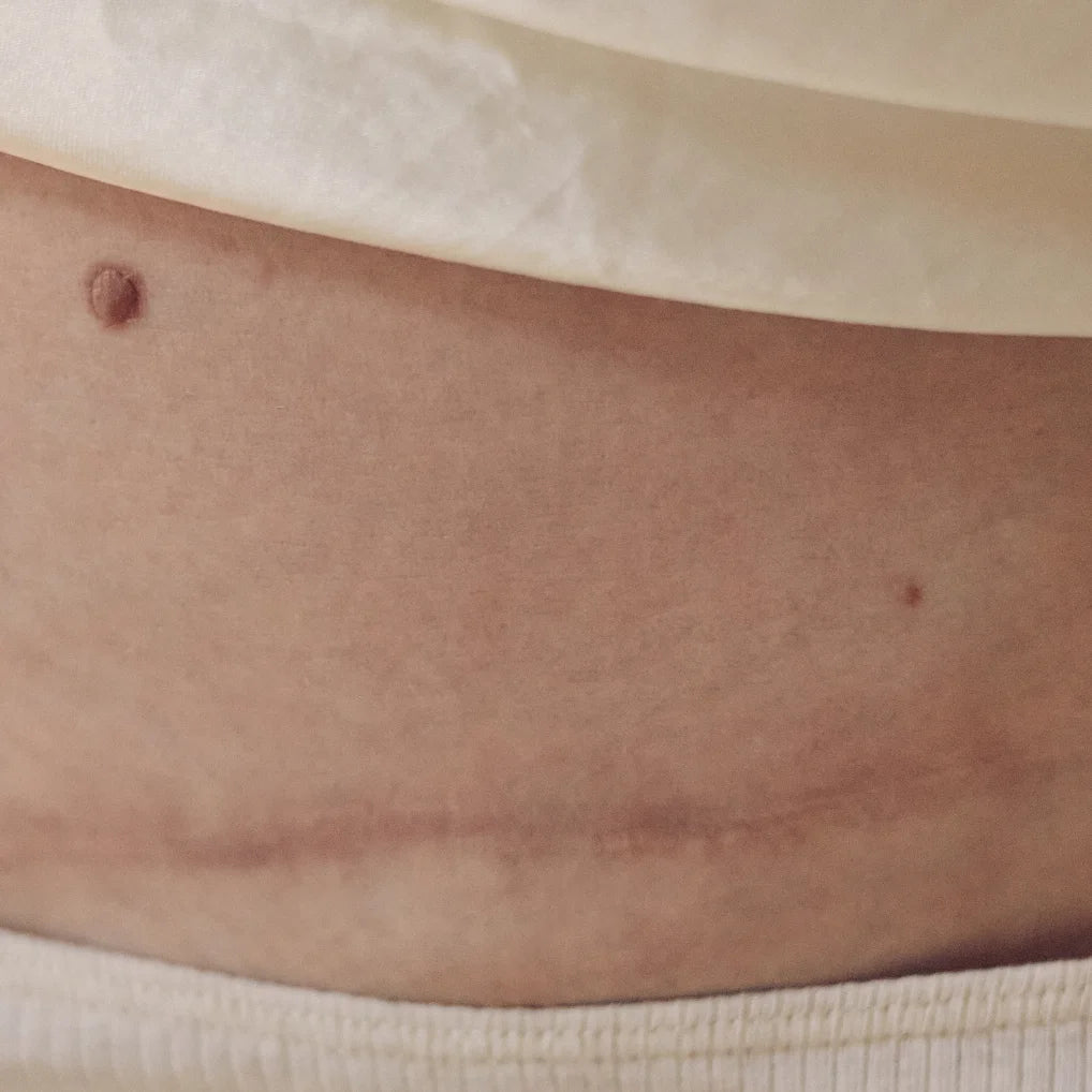 <p>Til dig, der står midt i det – eller lige skal til det</p>